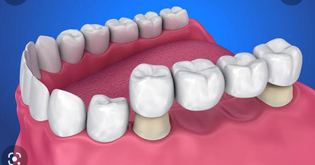 DR MUHAMMAD HASNAIN DENTAL CLINICS photo 4