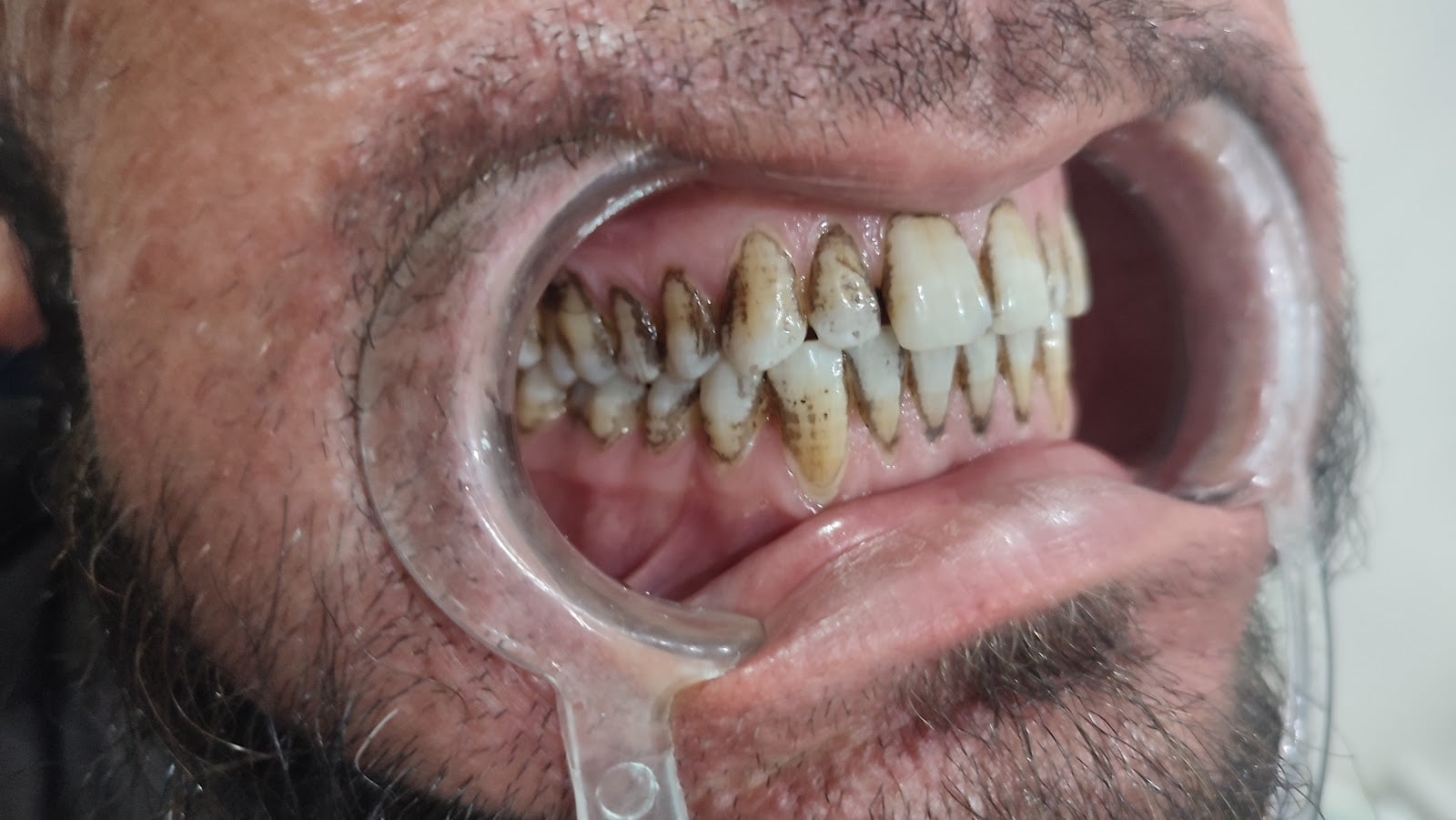 Dr Zeeshan Dental Clinic photo 4