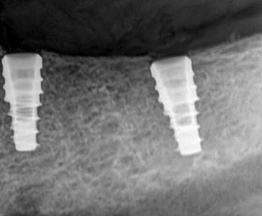 Pukhtoon Dentist photo 3