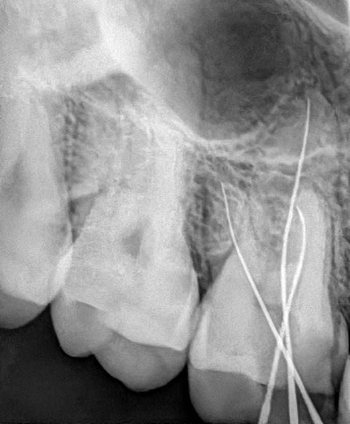 Pukhtoon Dentist photo 4