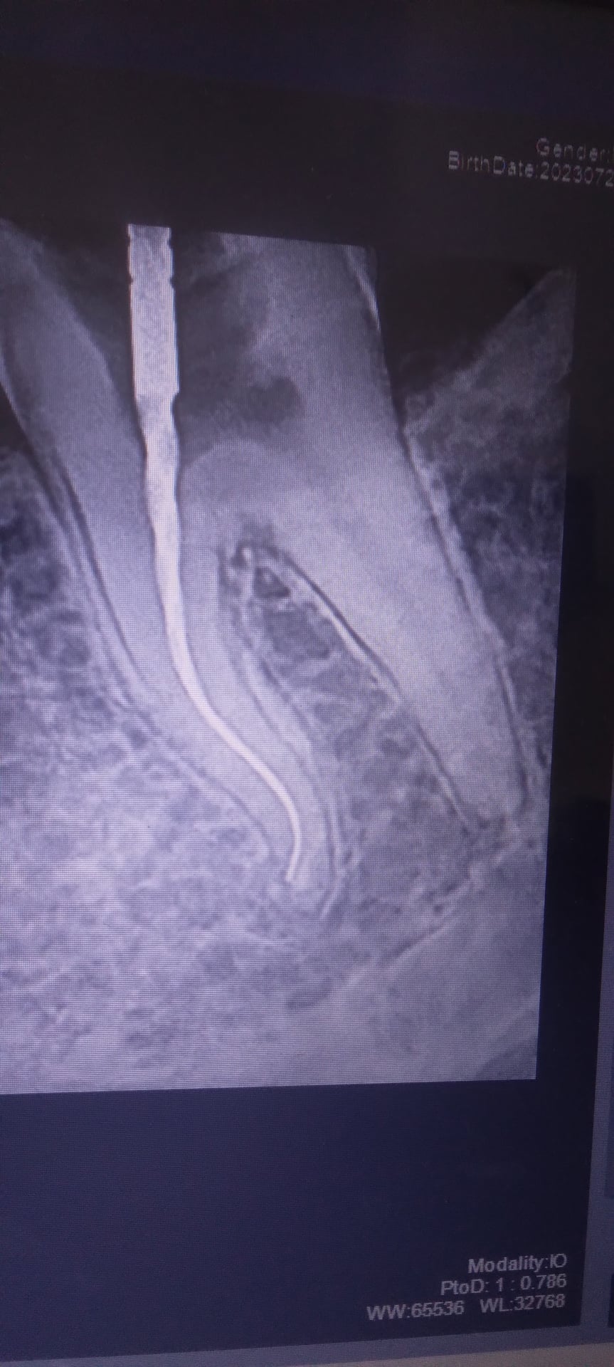Pukhtoon Dentist photo 5