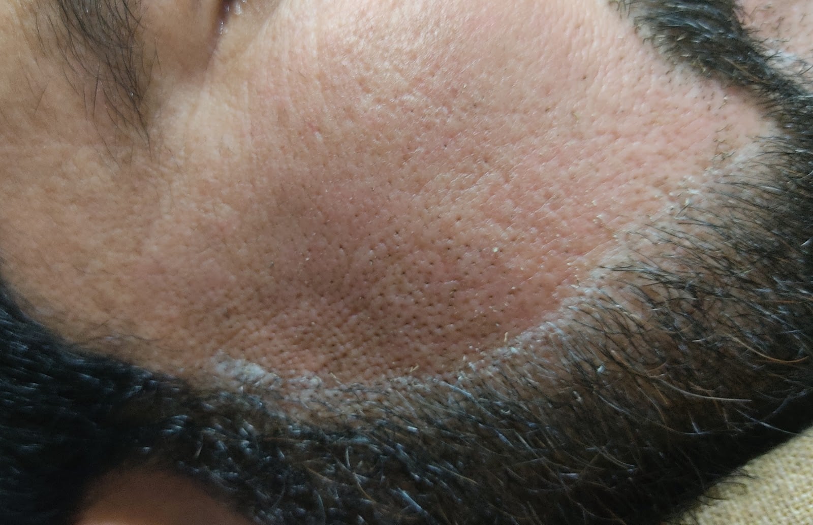 Skin Solutions & LASER centre (Dr Allauddin) photo 5